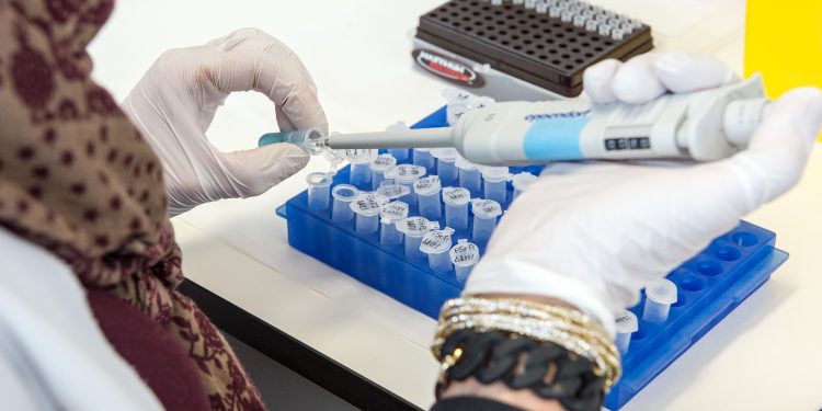Castilla-La Mancha registra 11 nuevos casos de viruela del mono en la última semana y suma 26 en total