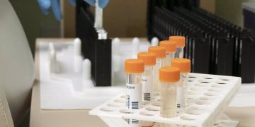 Castilla-La Mancha registra 12 nuevos casos de viruela del mono en la última semana y suma 38 en total