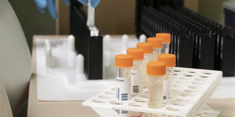 Castilla-La Mancha registra 12 nuevos casos de viruela del mono en la última semana y suma 38 en total