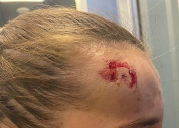Denuncian la agresión a una camarera de Valdepeñas por parte de un cliente que la acusó de tardar en servirle