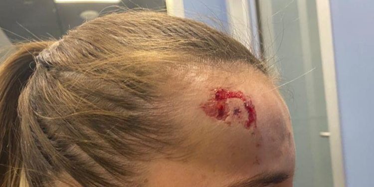 Denuncian la agresión a una camarera de Valdepeñas por parte de un cliente que la acusó de tardar en servirle