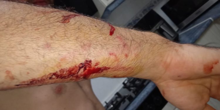 Dos perros atacan a un joven de 27 años provocándole múltiples heridas en el camino de la antigua discoteca La Caraba de Tomelloso